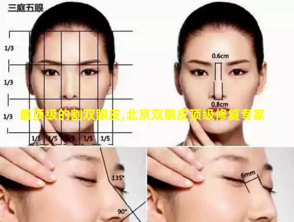 最顶级的割双眼皮,北京双眼皮顶级修复专家